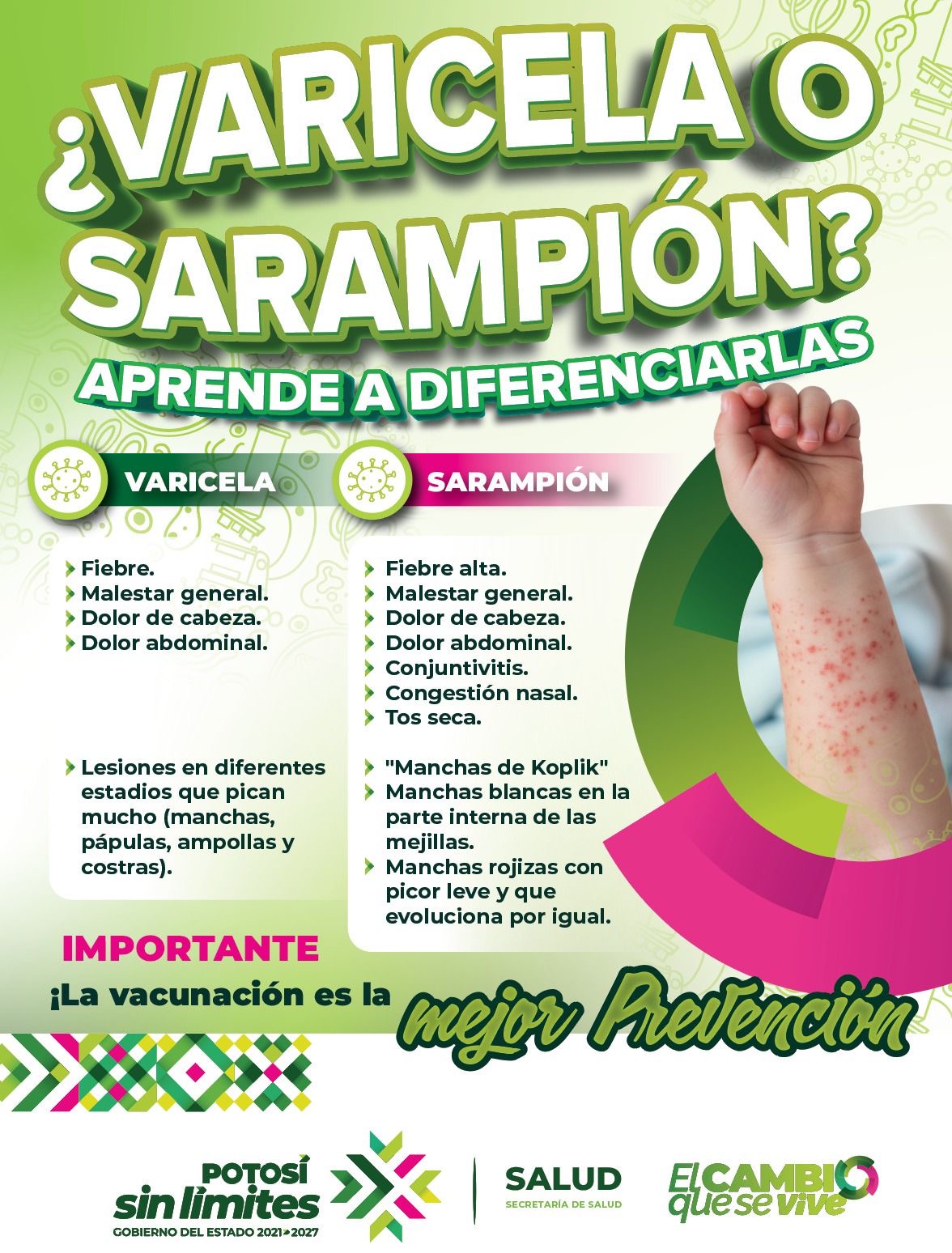 GOBIERNO DEL ESTADO REFUERZA CAMPAÑA INFORMATIVA SOBRE SARAMPIÓN Y VIRUELA